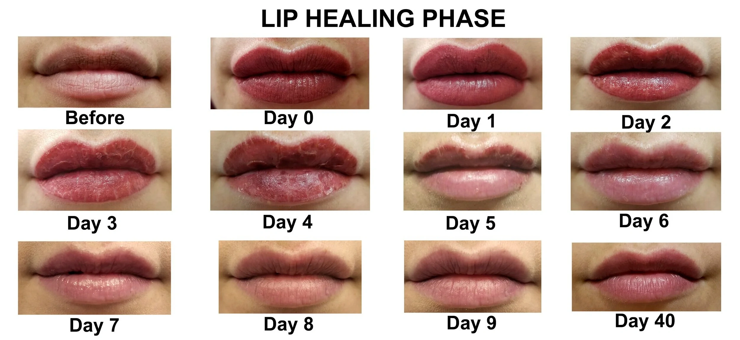 24 Stunning Lip Tattoo After 5 Years: What Happens Next