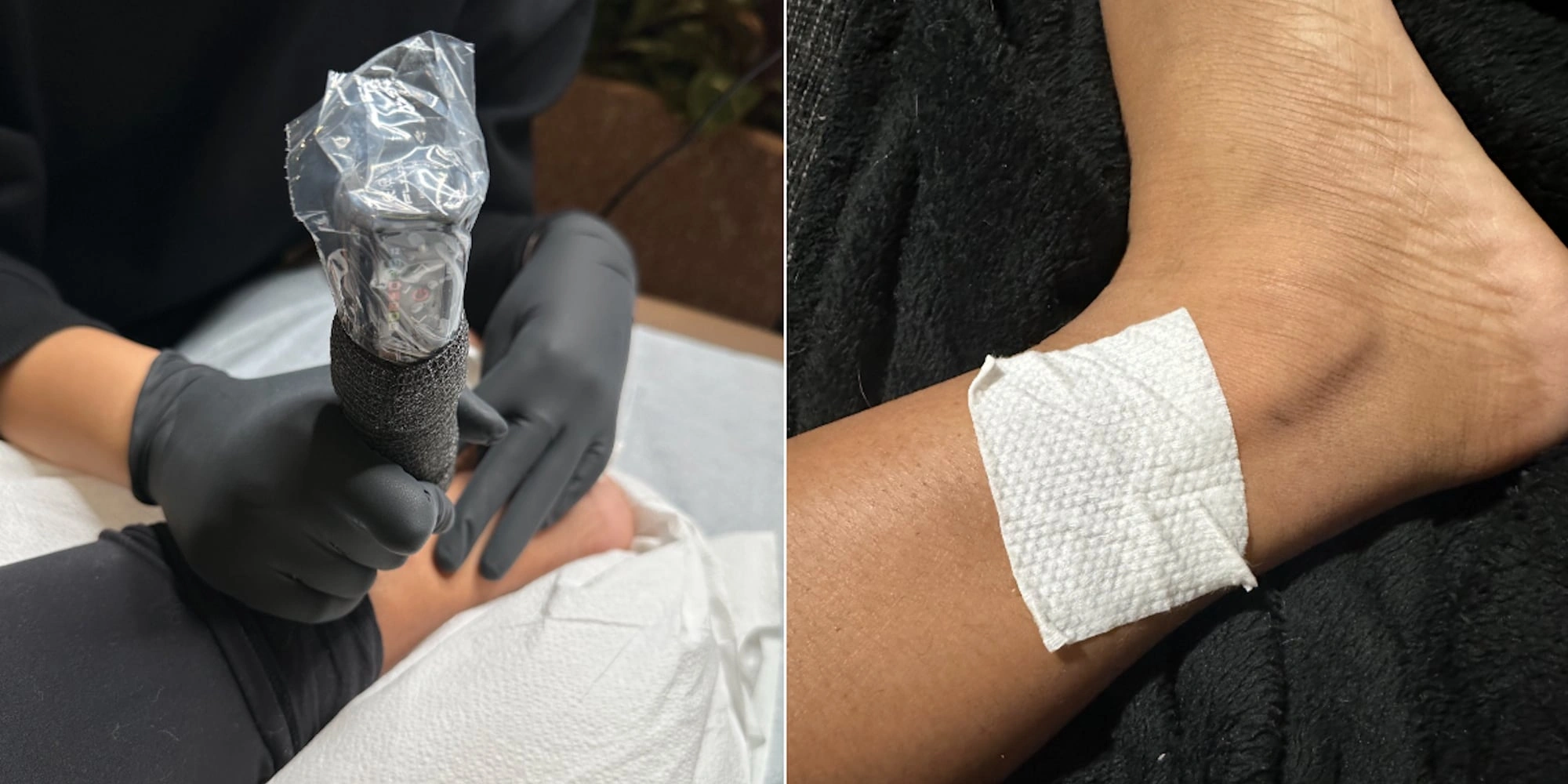 11 Vibrant Mad Rabbit Tattoo Repair Patch Quick Glow