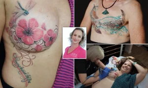 32 Stunning Tattoo Ideas For Breast Reduction Scar Cover‑Ups